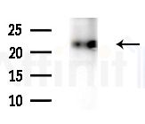 DIRA1 Antibody - Western blot analysis of extracts from HepG2 cells(LPS 4h treatment), using DIRA1 Antibody at 1/1000 dilution.