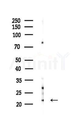 DIRA1 Antibody - Western blot analysis of lysates from HepG2 cells(LPS 4h treatment), using DIRA1 Antibody at 1/1000 dilution.