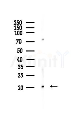DIRA1 Antibody - Western blot analysis of lysates from Hela cells, using DIRA1 Antibody at 1/1000 dilution.