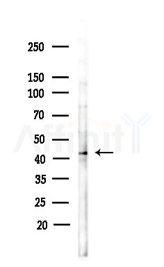 GNAI3 Antibody - Western blot analysis of lysates from COLO205 cells(heat-shock,45min treatment), using GNAI3 Antibody at 1/1000 dilution.