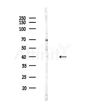 GNAL Antibody - Western blot analysis of lysates from COLO205 cells(UV,30min treatment), using GNAL Antibody at 1/1000 dilution.