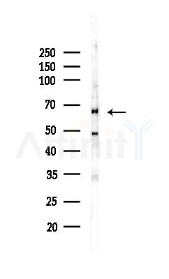 GNL3L Antibody - Western blot analysis of lysates from MCF7 cells(heat-shock,45min treatment), using GNL3L Antibody at 1/1000 dilution.