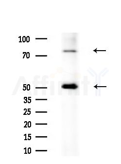 GBP3 Antibody - Western blot analysis of extracts from Mouse liver, using GBP3 Antibody at 1/1000 dilution.