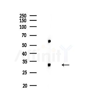 HOXA11/D11 Antibody - Western blot analysis of lysates from HUVEC cells, using HOXA11/D11 Antibody at 1/1000 dilution.
