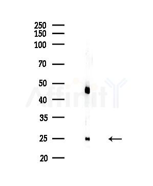 HOXA11/D11 Antibody - Western blot analysis of lysates from COLO205 cells, using HOXA11/D11 Antibody at 1/1000 dilution.