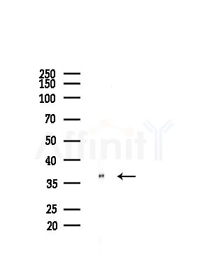 HOXA5 Antibody - Western blot analysis of lysates from Rat brain, using HOXA5 Antibody at 1/1000 dilution.