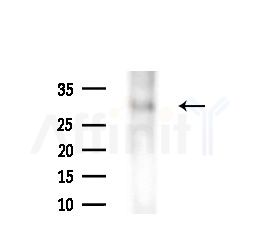 Msx2/Hox8 Antibody - Western blot analysis of extracts from B16F10-LUC cells(starvation,24h treatment), using Msx2/Hox8 Antibody at 1/1000 dilution.