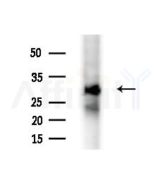 Msx2/Hox8 Antibody - Western blot analysis of extracts from HepG2 cells(starvation,24h treatment), using Msx2/Hox8 Antibody at 1/1000 dilution.