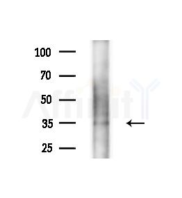Msx2/Hox8 Antibody - Western blot analysis of extracts from B16F10-LUC cells(starvation,24h treatment), using Msx2/Hox8 Antibody at 1/1000 dilution.