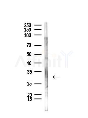 Msx2/Hox8 Antibody - Western blot analysis of lysates from B16F10-LUC cells(starvation,24h treatment), using Msx2/Hox8 Antibody at 1/1000 dilution.