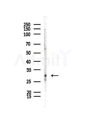Msx2/Hox8 Antibody - Western blot analysis of lysates from HepG2 cells(starvation,24h treatment), using Msx2/Hox8 Antibody at 1/1000 dilution.