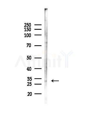 Msx2/Hox8 Antibody - Western blot analysis of lysates from B16F10-LUC cells(starvation,24h treatment), using Msx2/Hox8 Antibody at 1/1000 dilution.