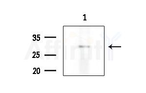 NKX26 Antibody - Western blot analysis of extracts from COLO205 cells, using NKX26 Antibody at 1/1000 dilution.