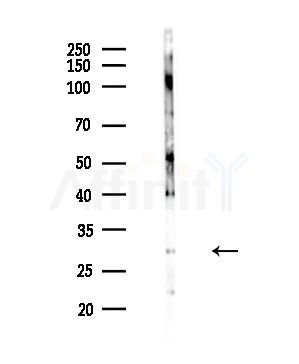 NKX26 Antibody - Western blot analysis of lysates from COLO205 cells, using NKX26 Antibody at 1/1000 dilution.