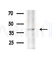KCNN4 Antibody - Western blot analysis of extracts from HepG2 cells
(heat-shock treatment), using KCNN4 Antibody at 1/1000 dilution.
