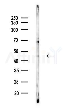 KCNN4 Antibody - Western blot analysis of lysates from HepG2 cells(heat-shock,45min treatment), using KCNN4 Antibody at 1/1000 dilution.