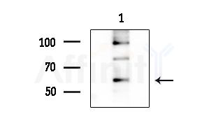 LIPI Antibody - Western blot analysis of extracts from Mouse testis, using LIPI Antibody at 1/1000 dilution.