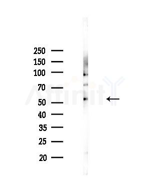 LIPI Antibody - Western blot analysis of lysates from Mouse testis, using LIPI Antibody at 1/1000 dilution.