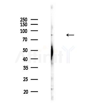 ACSL6 Antibody - Western blot analysis of lysates from Rat brain, using ACSL6 Antibody at 1/1000 dilution.