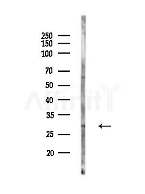 LDLRAD2 Antibody - Western blot analysis of lysates from COLO205 cells, using LDLRAD2 Antibody at 1/1000 dilution.