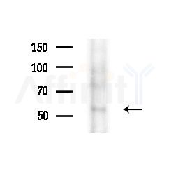 LRP11 Antibody - Western blot analysis of extracts from Rat brain, using LRP11 Antibody at 1/1000 dilution.