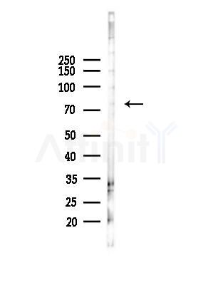 LRP3 Antibody - Western blot analysis of lysates from B16F10-LUC cells(heat-shock,45min treatment), using LRP3 Antibody at 1/1000 dilution.