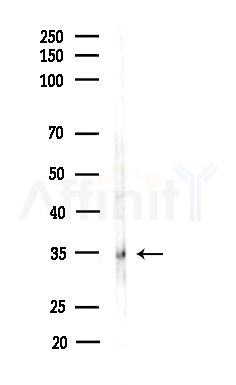 LFA3 Antibody - Western blot analysis of lysates from B16F10-LUC cells(starvation,24h treatment), using LFA3 Antibody at 1/1000 dilution.