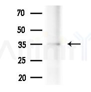 MAD2L1BP Antibody - Western blot analysis of extracts from Mouse liver, using MAD2L1BP Antibody at 1/1000 dilution.