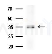 MAD2L1BP Antibody - Western blot analysis of extracts from B16F10-LUC cells
(heat-shock treatment), using MAD2L1BP Antibody at 1/1000 dilution.