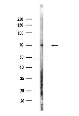 MASP2 Antibody - Western blot analysis of lysates from A375 cells(LPS,4h treatment), using MASP2 Antibody at 1/1000 dilution.