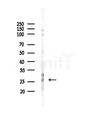 MBL2 Antibody - Western blot analysis of lysates from RAW264.