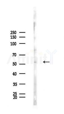 GSDMC Antibody - Western blot analysis of lysates from Rat brain, using GSDMC Antibody at 1/1000 dilution.