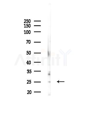 PGRMC2 Antibody - Western blot analysis of lysates from Hela cells, using PGRMC2 Antibody at 1/1000 dilution.