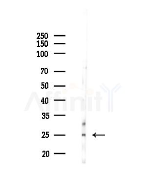 PGRMC2 Antibody - Western blot analysis of lysates from COLO205 cells, using PGRMC2 Antibody at 1/1000 dilution.