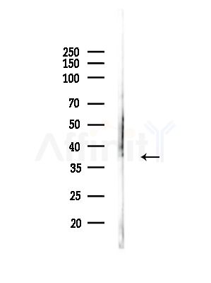 CLNS1A Antibody - Western blot analysis of lysates from COLO205 cells, using CLNS1A Antibody at 1/1000 dilution.