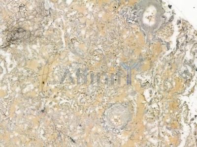 MRPS21 Antibody - DF4165 at 1/100 staining human normal lung tissue by IHC-P.