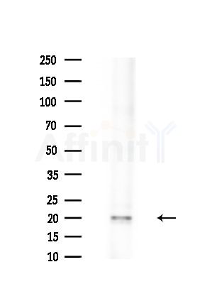 MRPS25 Antibody - Western blot analysis of extracts from Mouse liver, using MRPS25 Antibody at 1/1000 dilution.