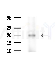 MRPS25 Antibody - Western blot analysis of extracts from HUVEC cells(starvation,24h treatment), using MRPS25 Antibody at 1/1000 dilution.