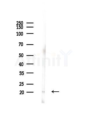 MRPS25 Antibody - Western blot analysis of lysates from Mouse liver, using MRPS25 Antibody at 1/1000 dilution.