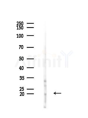 MRPS25 Antibody - Western blot analysis of lysates from HUVEC cells(starvation,24h treatment), using MRPS25 Antibody at 1/1000 dilution.