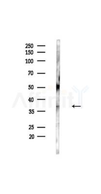 SLC25A11 Antibody - Western blot analysis of lysates from HUVEC cells(UV,30min treatment), using SLC25A11 Antibody at 1/1000 dilution.