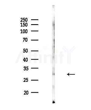 MRPL4 Antibody - Western blot analysis of lysates from Rat brain, using MRPL4 Antibody at 1/1000 dilution.