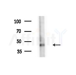 MOT14 Antibody - Western blot analysis of extracts from HepG2 cells(starvation,24h treatment), using MOT14 Antibody at 1/1000 dilution.