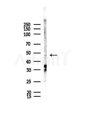 MOT14 Antibody - Western blot analysis of lysates from HepG2 cells(starvation,24h treatment), using MOT14 Antibody at 1/1000 dilution.