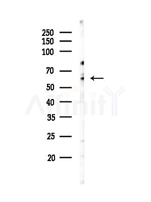 SLC16A2 Antibody - Western blot analysis of lysates from Hela cells(starvation,24h treatment), using SLC16A2 Antibody at 1/1000 dilution.