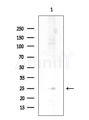 MDFI Antibody - Western blot analysis of extracts from HUVEC cells, using MDFI Antibody at 1/1000 dilution.
