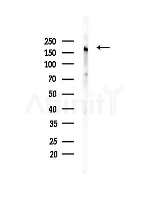 MYOM2 Antibody - Western blot analysis of lysates from Rat brain, using MYOM2 Antibody at 1/1000 dilution.