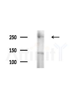 MYO5A Antibody - Western blot analysis of extracts from PC12 cells(starvation,24h treatment), using MYO5A Antibody at 1/1000 dilution.