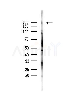 MYO5A Antibody - Western blot analysis of lysates from PC12 cells(starvation,24h treatment), using MYO5A Antibody at 1/1000 dilution.