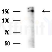 NACAD Antibody - Western blot analysis of extracts from Rat brain, using NACAD Antibody at 1/1000 dilution.